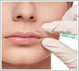 Морщины вокруг губ Морщины вокруг губ